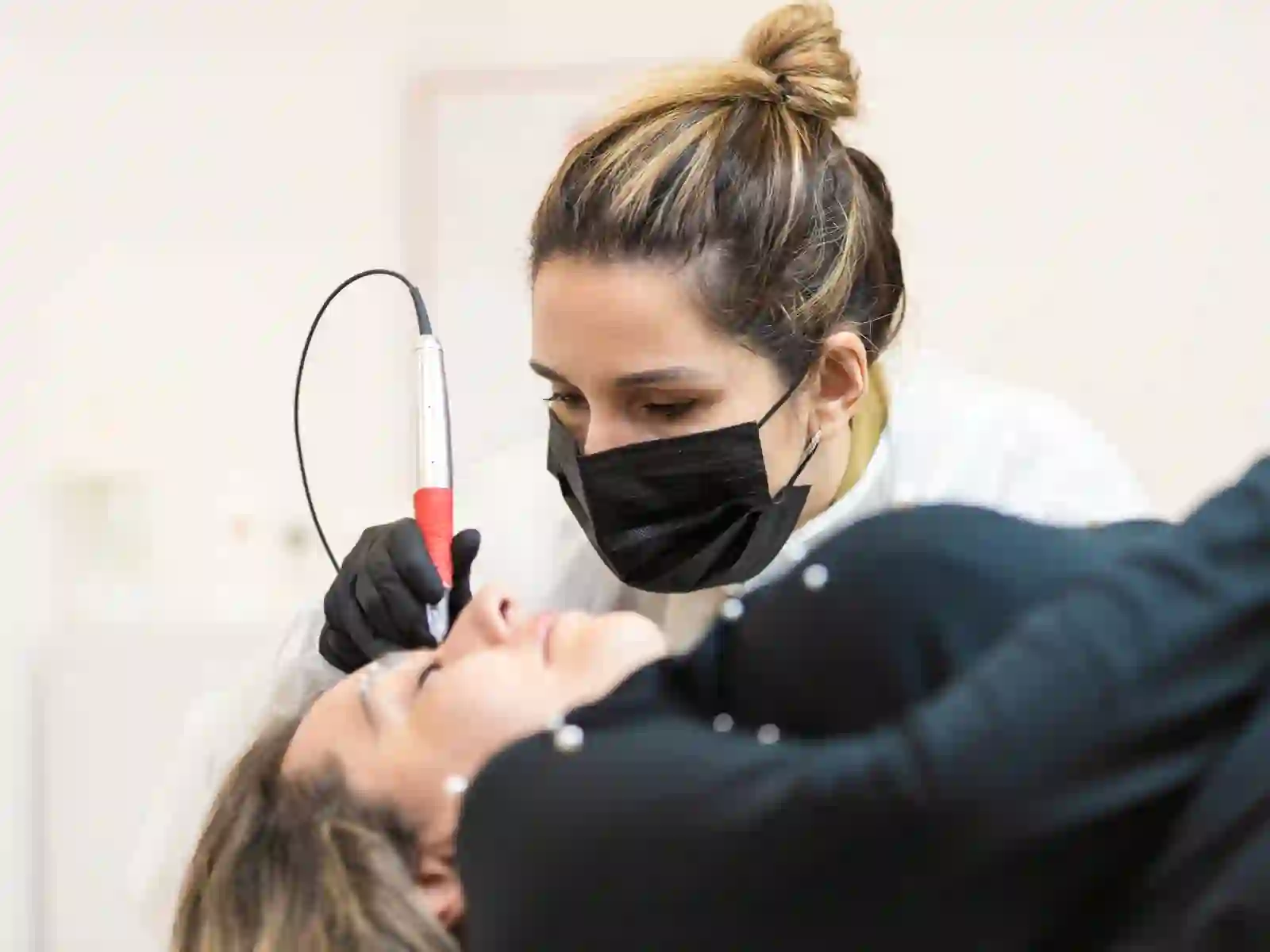 Remoção de Tatuagem